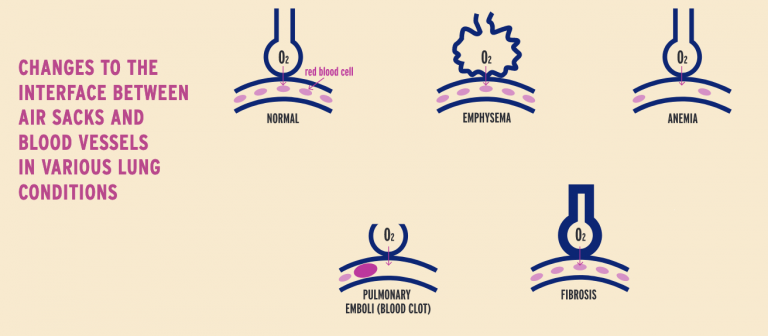 diffusing-capacity-dlco-alphanet