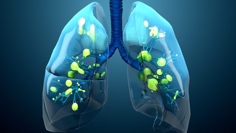 Common Lung Diseases - AlphaNet